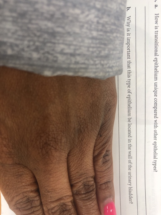 Solved a how is transitional epithelium unique compared chegg