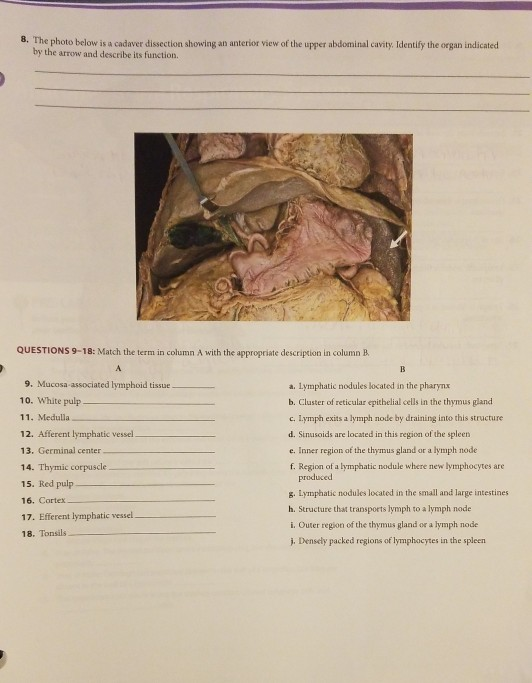 Solved 8. The photo below is a cadaver dissection showing an