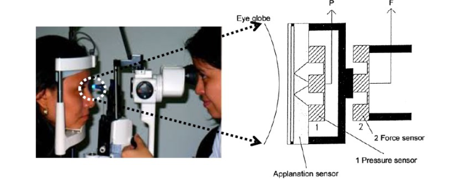 Fig. Q5 shows a schematic diagram of the applanation | Chegg.com