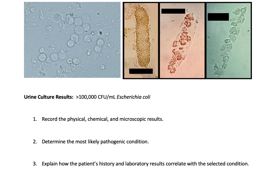 Make the Diagnosis: Fever and Flank Pain -- What's Up? - Medpage Today