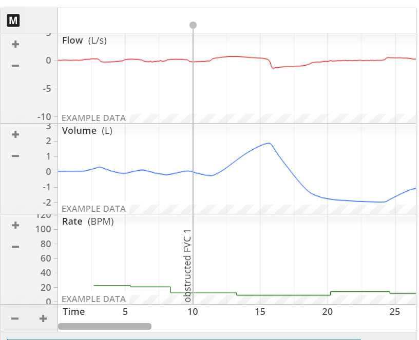 Solved M Flow L S 5 10 Example Data 3 Volume L Chegg Com