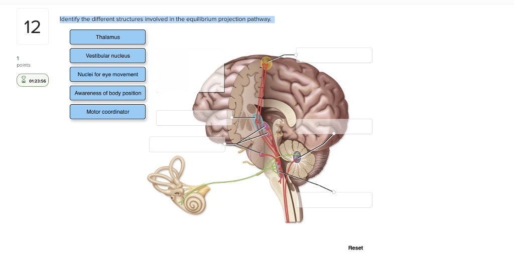 Solved Identify the different structures involved in the | Chegg.com