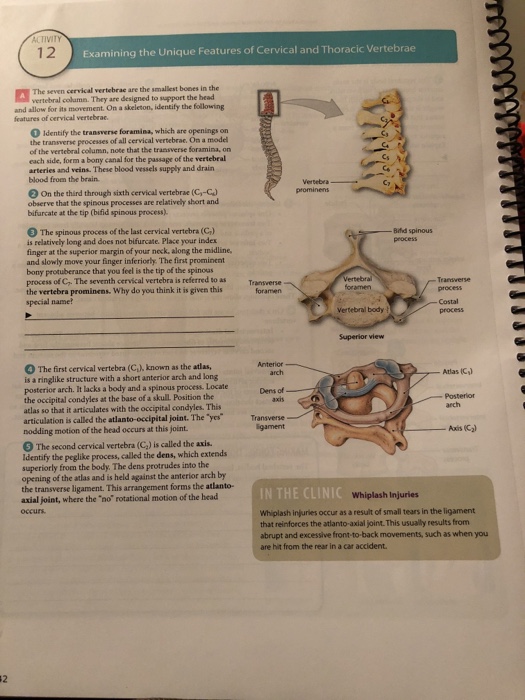 Solved Classifying Bones According to Location Bones can be | Chegg.com