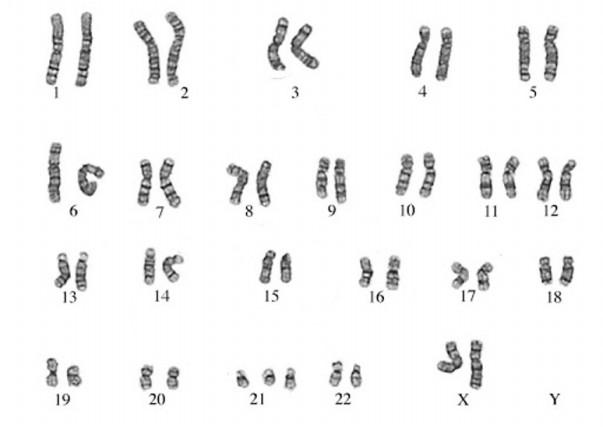 Solved Refer To The Human Karyotype Below To Answer The | Chegg.com