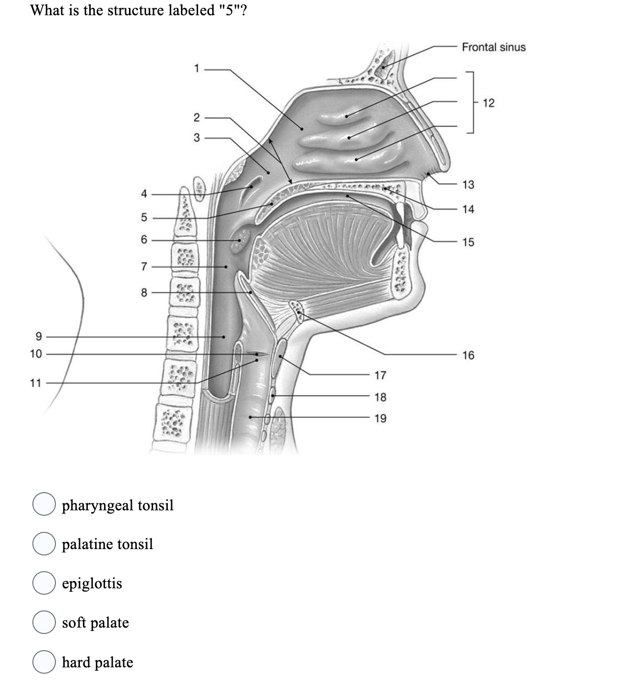 Solved What is the structure labeled 