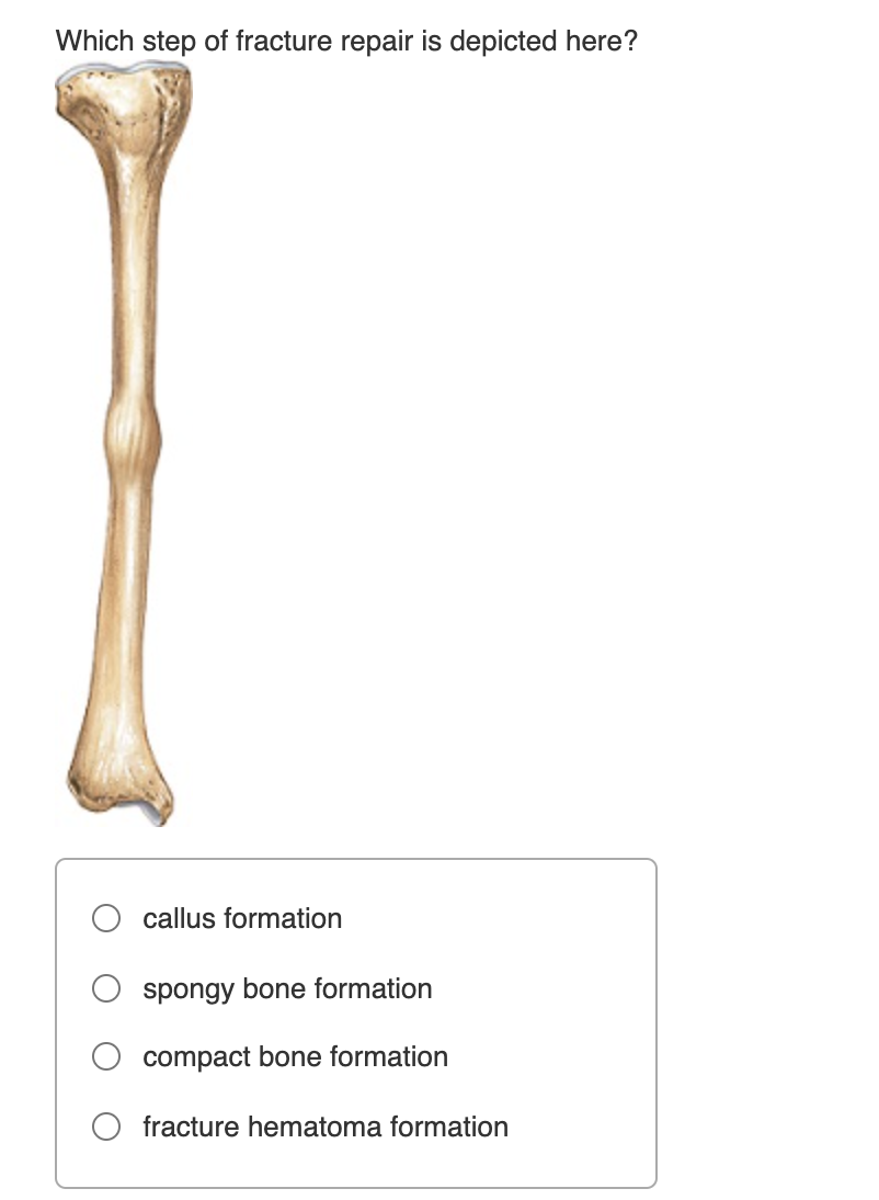 Solved Which step of fracture repair is depicted here?