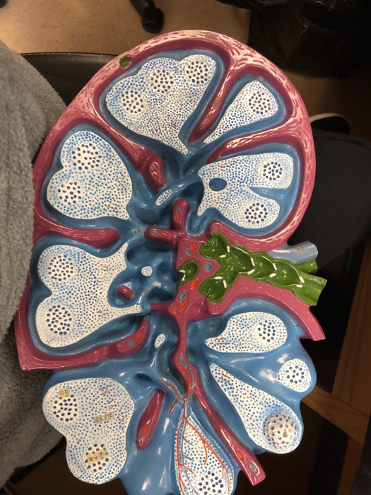 Solved Label lymph node | Chegg.com