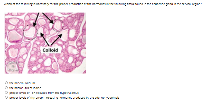 Solved the structure is found in the diencephalon of the | Chegg.com