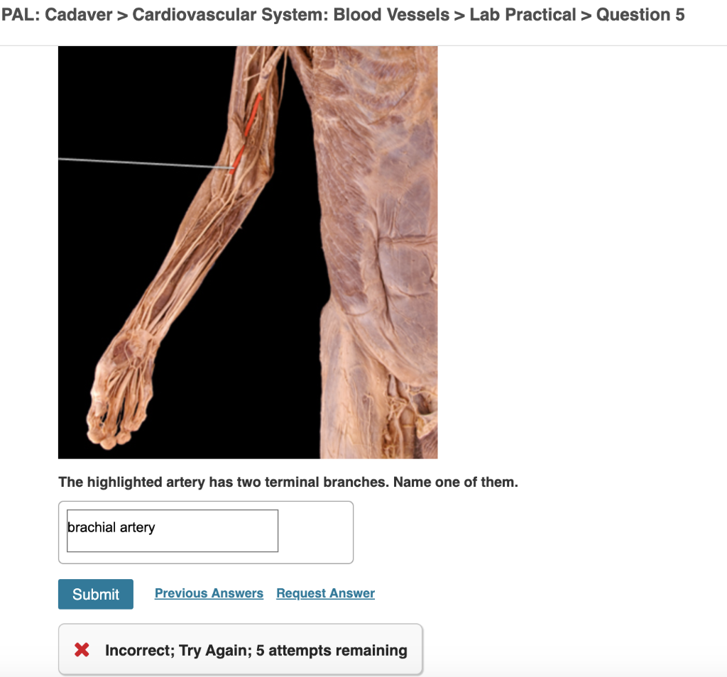 Solved PAL Cadaver > Cardiovascular System Blood Vessels >