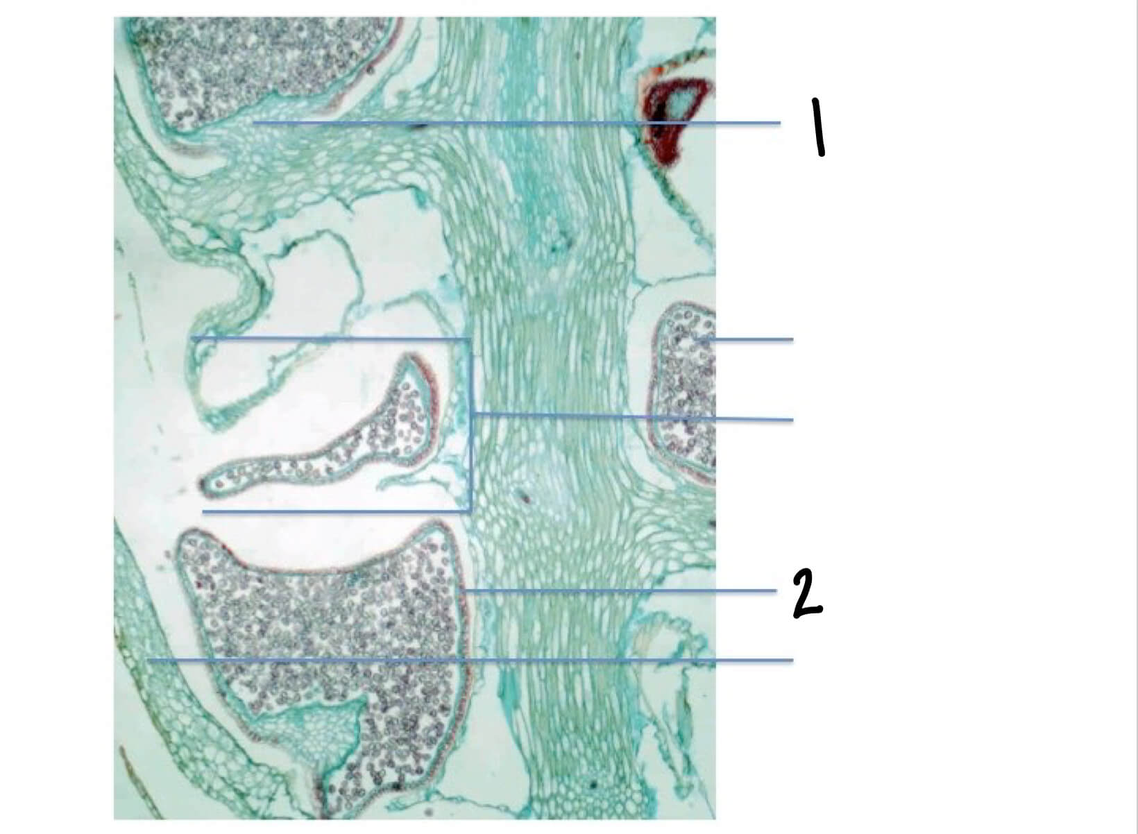 Solved Please Label The Lycopodium Spp Strobilus Cell Chegg Com