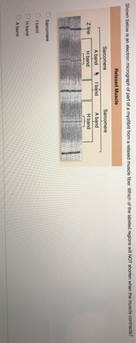 Solved Shown below is an electron micrograph of part of a | Chegg.com