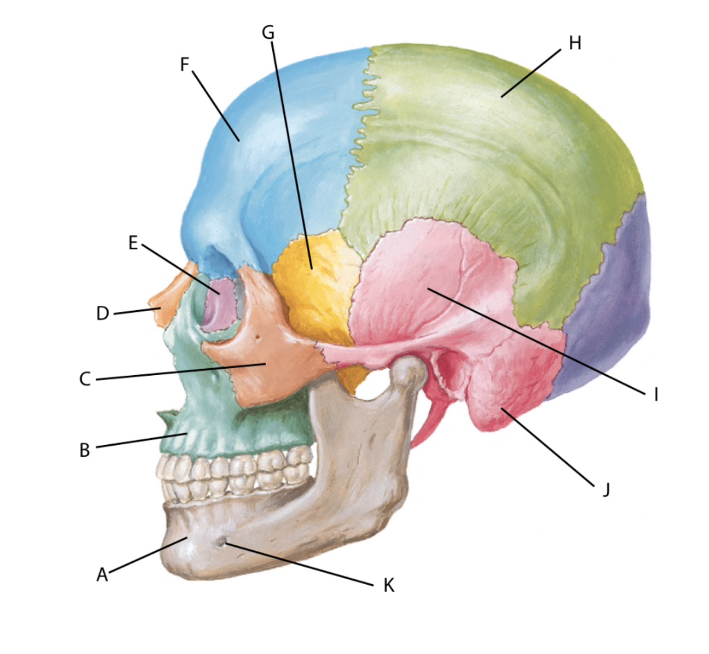 Solved Zygomatic Squamous temporal Lacrimal Parietal Maxilla | Chegg ...