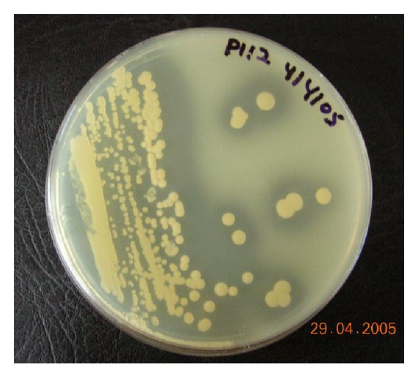 Solved 1.A skim milk agar plate is shown below. The microbe