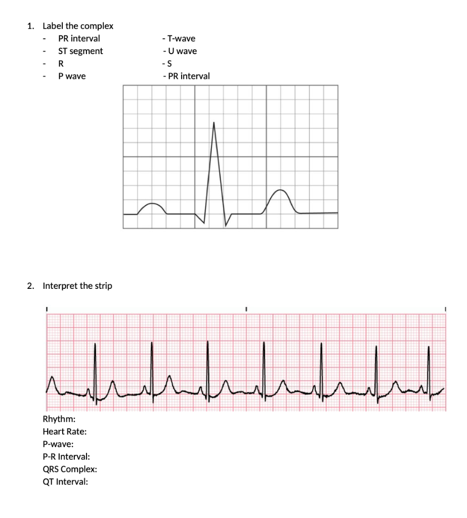Solved 1. Label the complex - PR interval - ST segment - R | Chegg.com