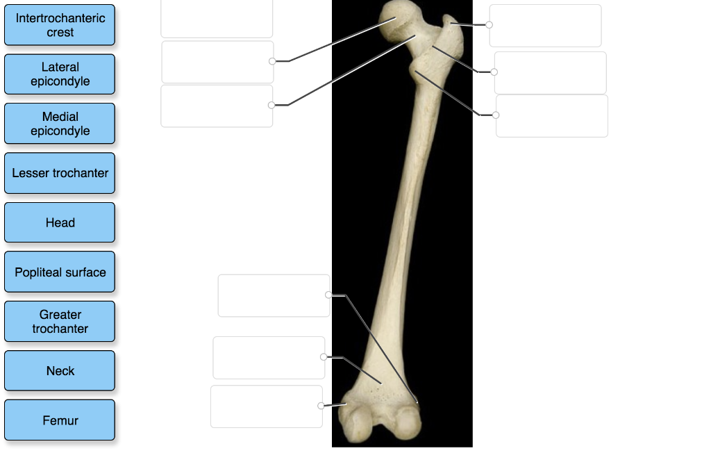 Solved: Label The Structures Of A Typical Vertebra. Transv... | Chegg.com