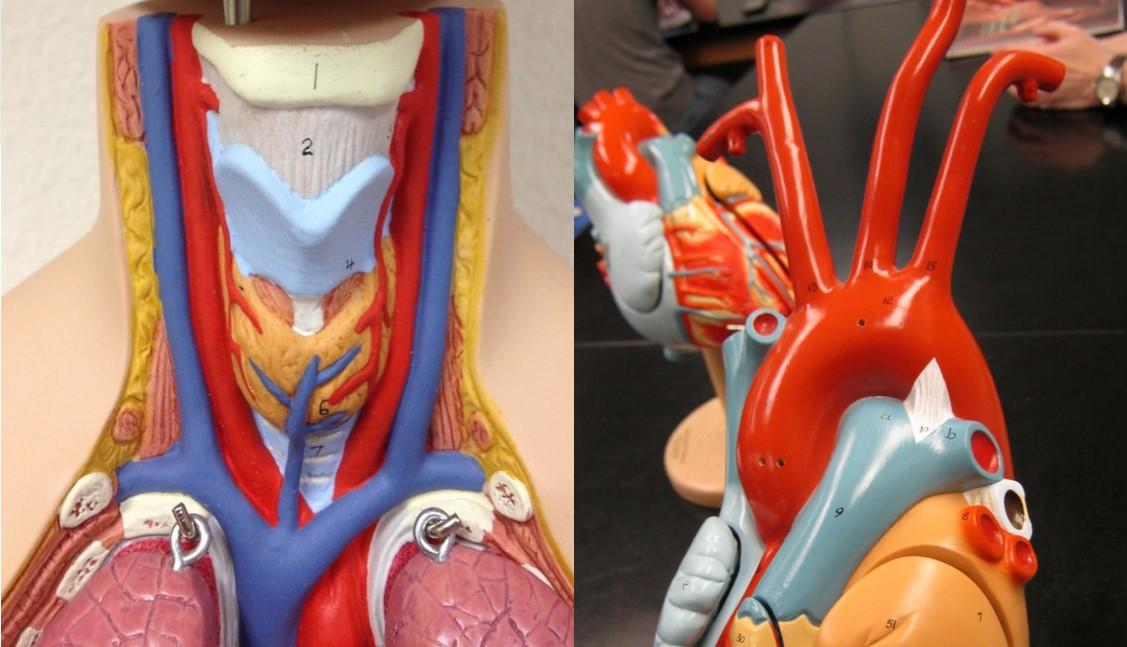 Solved Label R subclavian v, R internal jugular v, | Chegg.com