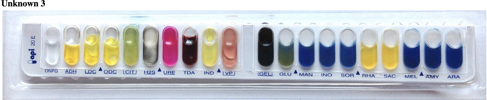 Solved Find all 3 unknowns from API 20 E strip (7 digit code | Chegg.com