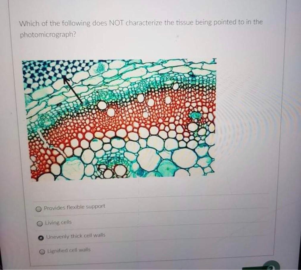 Solved What are the two basic types of xylem cells based on