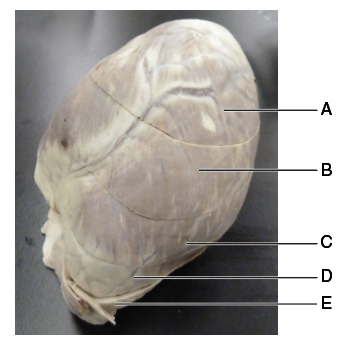 Solved Transverse Sections through the Heart from Apex to | Chegg.com