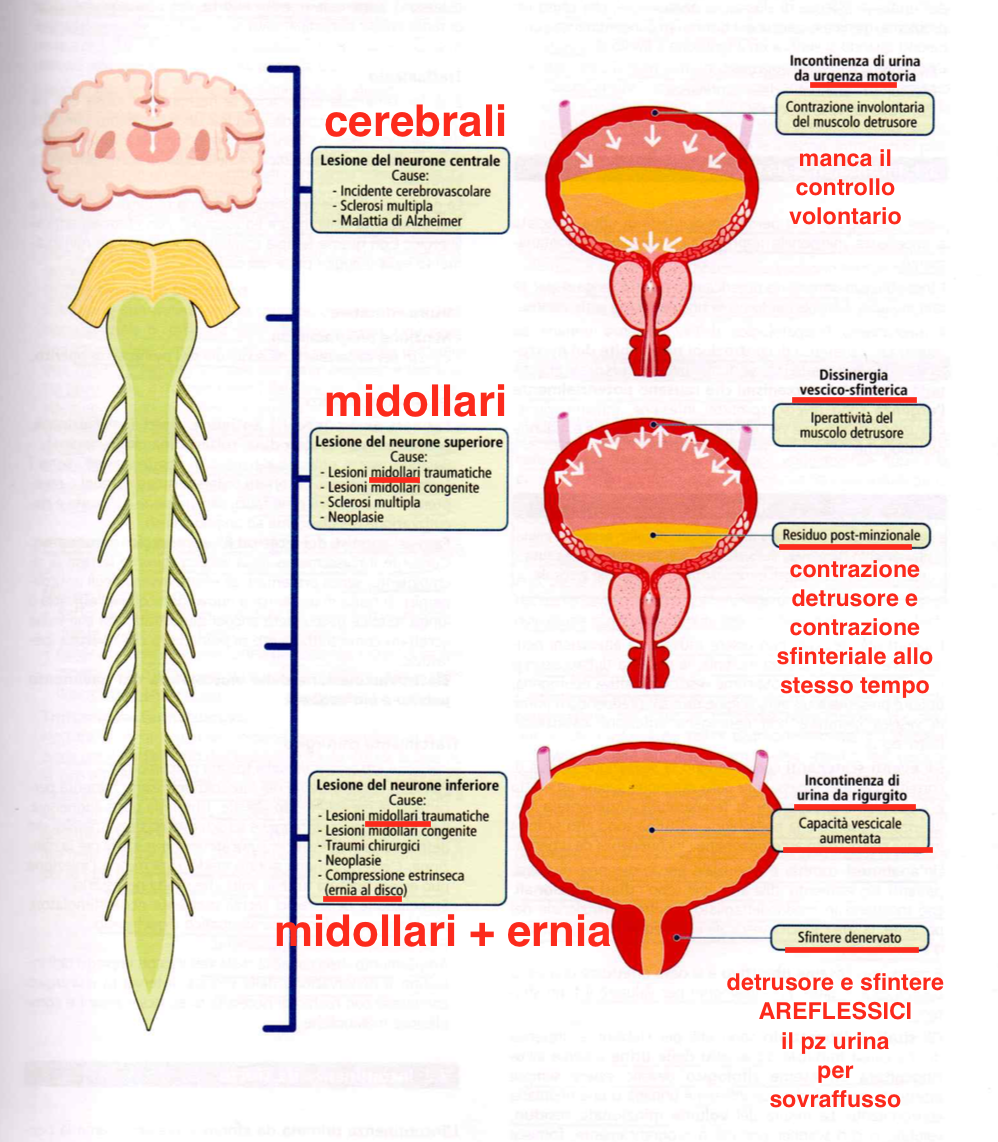 muscolo detrusore