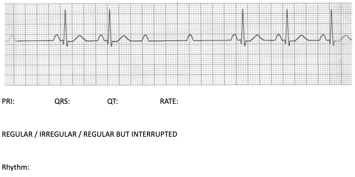 Solved REGULAR / IRREGULAR / REGULAR BUT INTERRUPTED