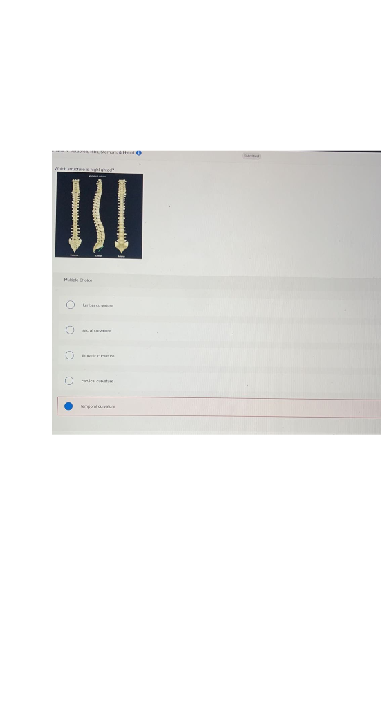 Solved Which structure is highlighted ? lumbar