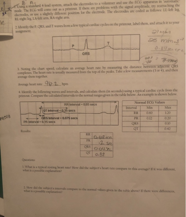 and use the ECG apparatus in automatsc 8 A Using a | Chegg.com