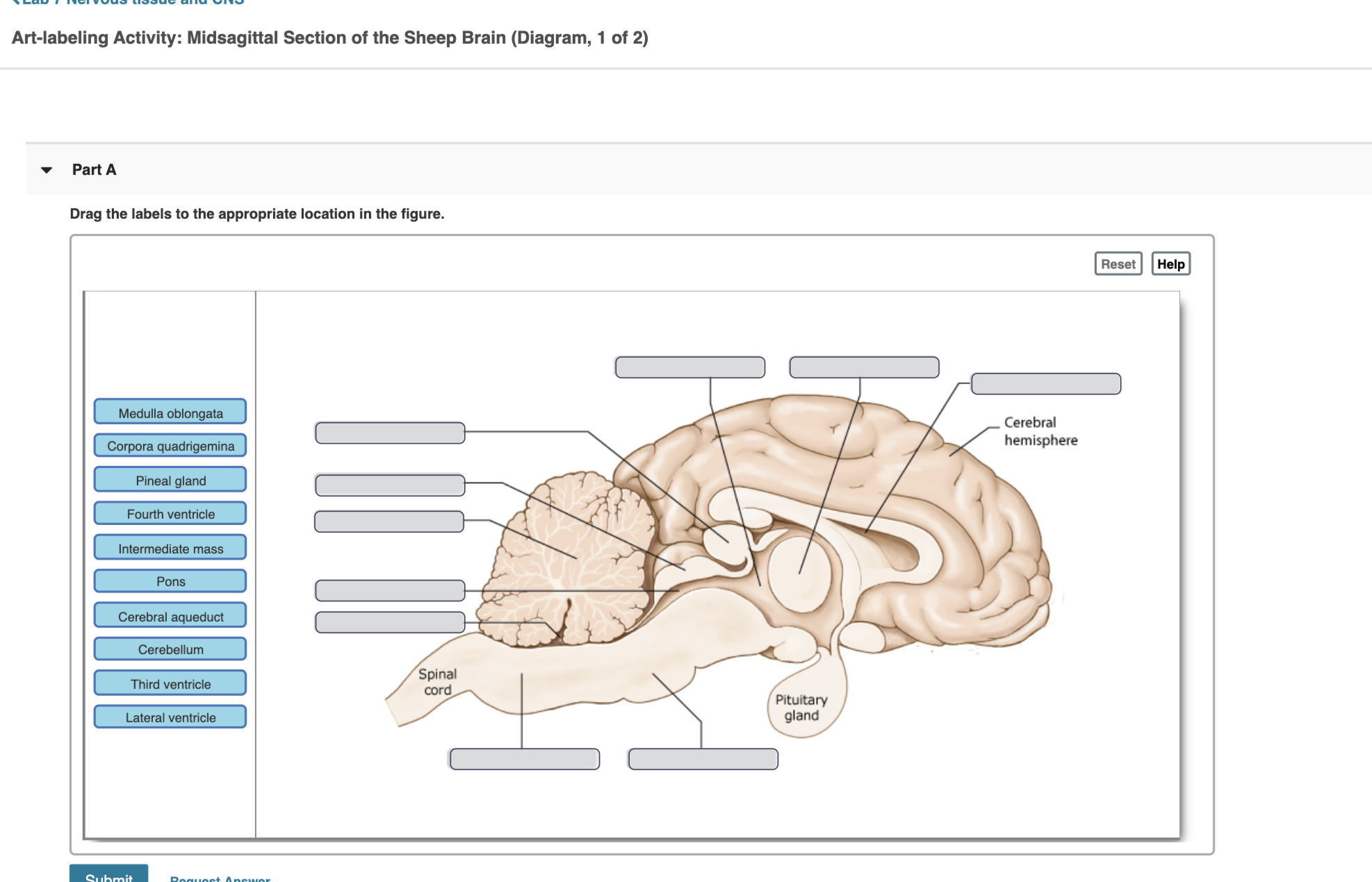 midsagittal section of the brain labeled