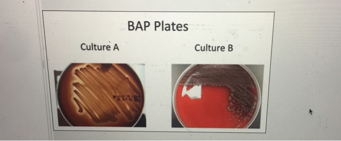 Solved BAP Plates Culture A Culture B | Chegg.com