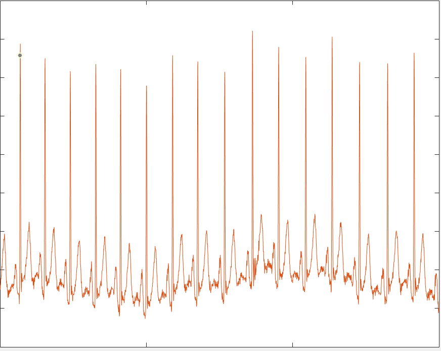 Hellooo !!! i need a code for matlab for an | Chegg.com