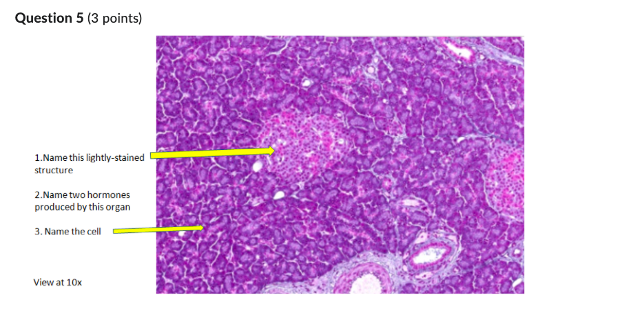 Solved Question 5 (3 points) 1.Name this lightly-stained | Chegg.com