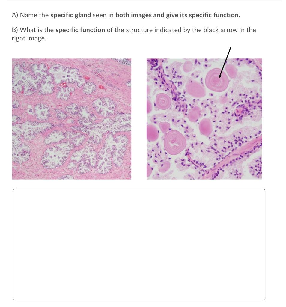 Solved A) Name the specific gland seen in both images and | Chegg.com