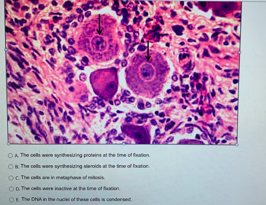 companion cells are devoid of nuclei true or false