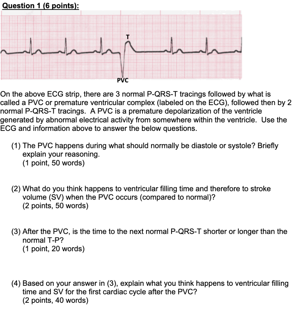 PVC Premature Ventricular Contraction By