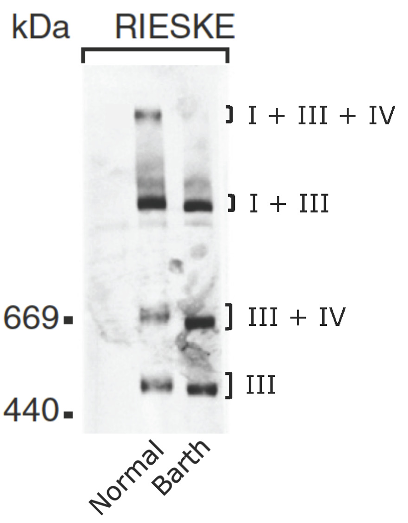 antibodies are not used in northern blot analysis chegg antibodies are not used in northern blot analysis chegg