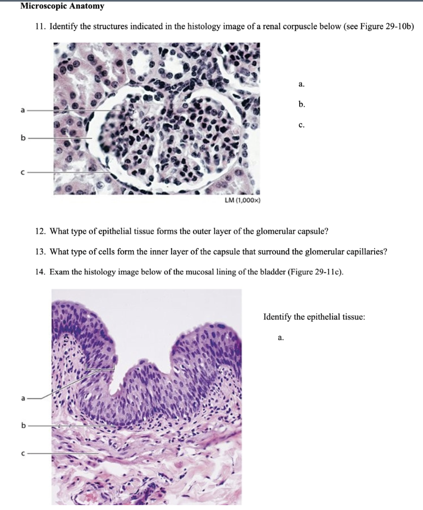renal corpuscle histology labeled