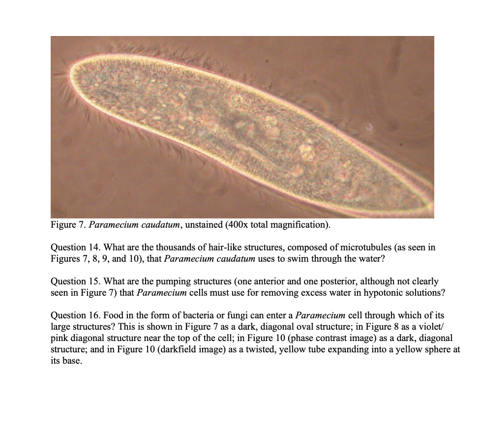 paramecium under microscope 400x