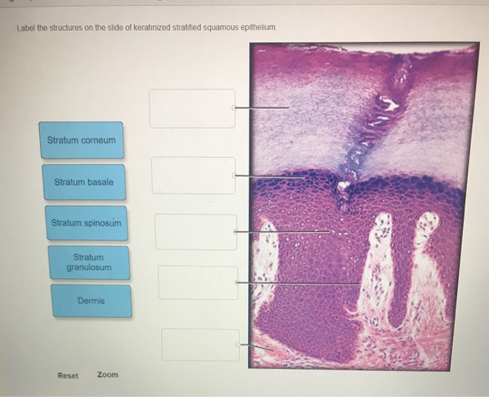 Solved Label the structures on the slide of keratinized | Chegg.com