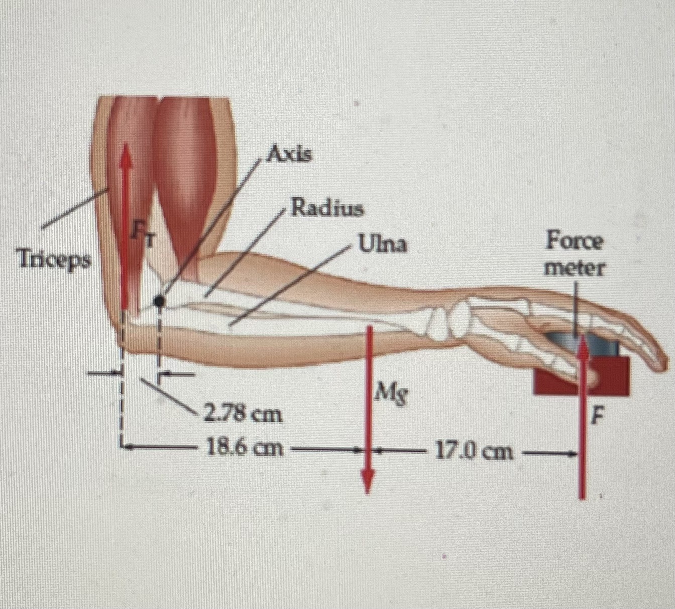 3. Doctors use a force meter to determine the force | Chegg.com