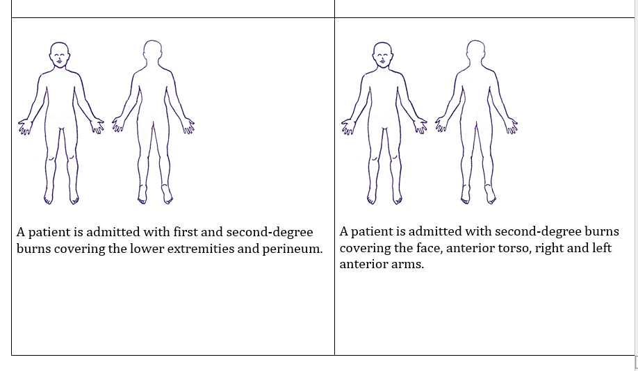Solved Burns Rule of Nines Directions Shade in the burn