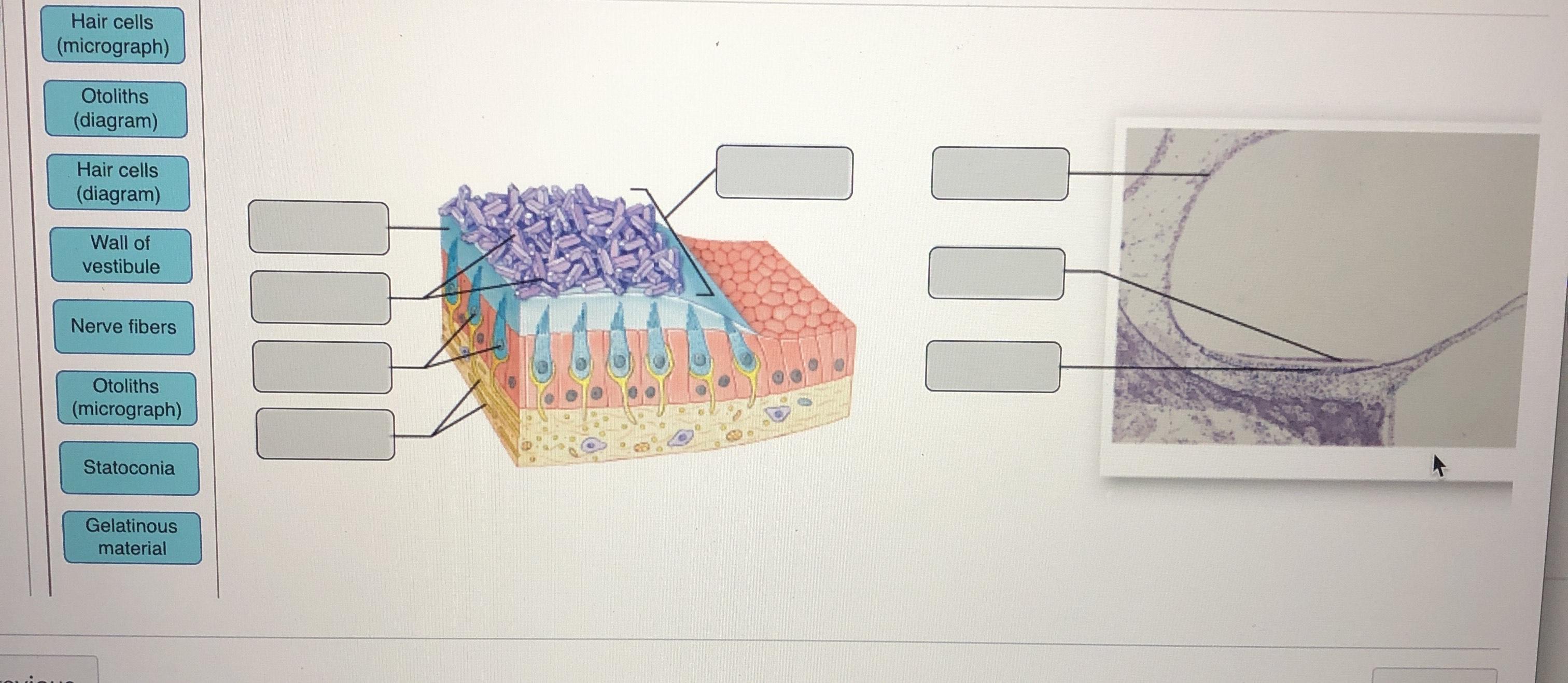 Solved Hair cells (micrograph) Otoliths (diagram) Hair cells | Chegg.com