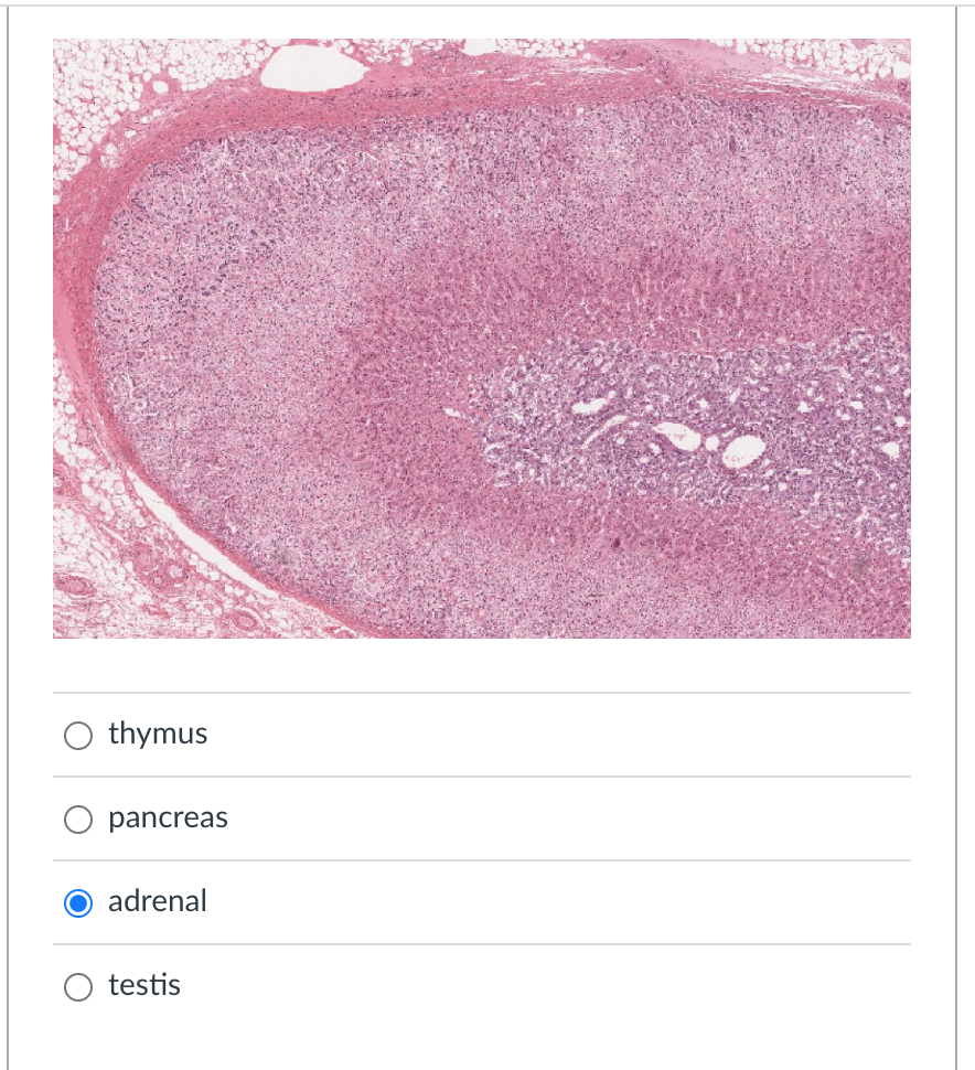 Solved Identify The Endocrine Gland Shown In This Gross And