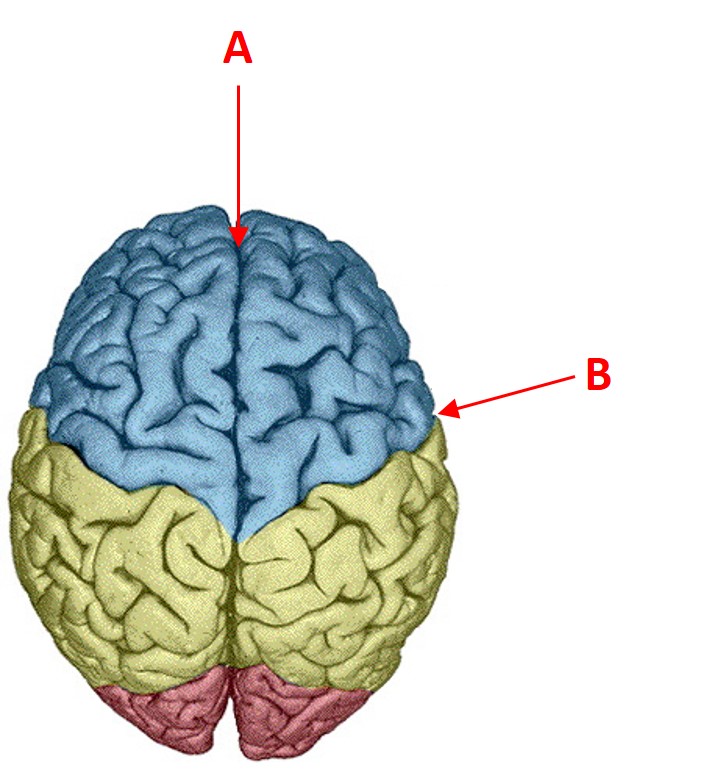 Solved What Groove Is Indicated By The Letter A Chegg solved-what-groove-is-indicated-by-the-letter-a-chegg