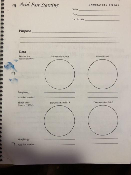 Solved AcidFast Staining LABORATORY REPORT Name, Date Lab
