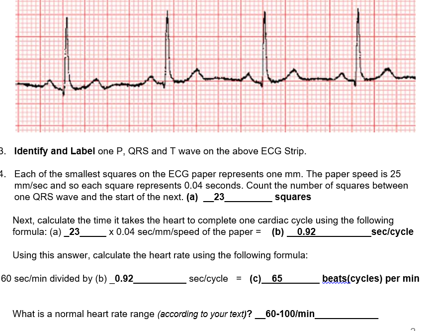 Cv physiology electrocardiogram ekg ecg 59 off