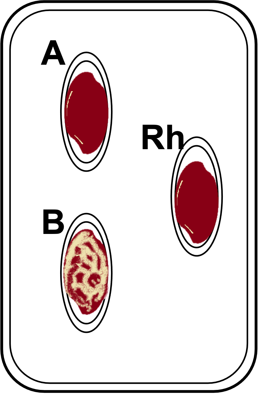 Solved A Rh В. A Rh B. A Rh B. Ho | Chegg.com