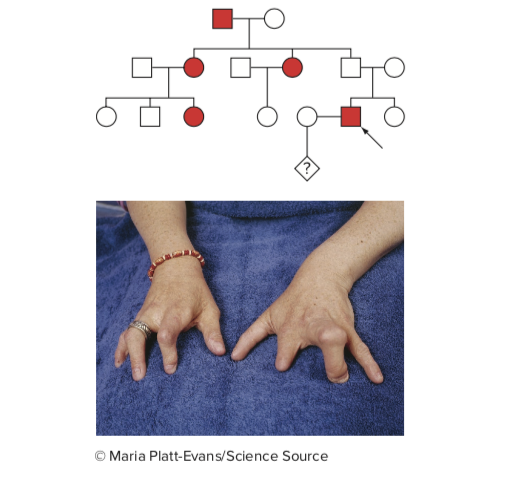 Solved A Couple Wants To Know The Probability That Their | Chegg.com