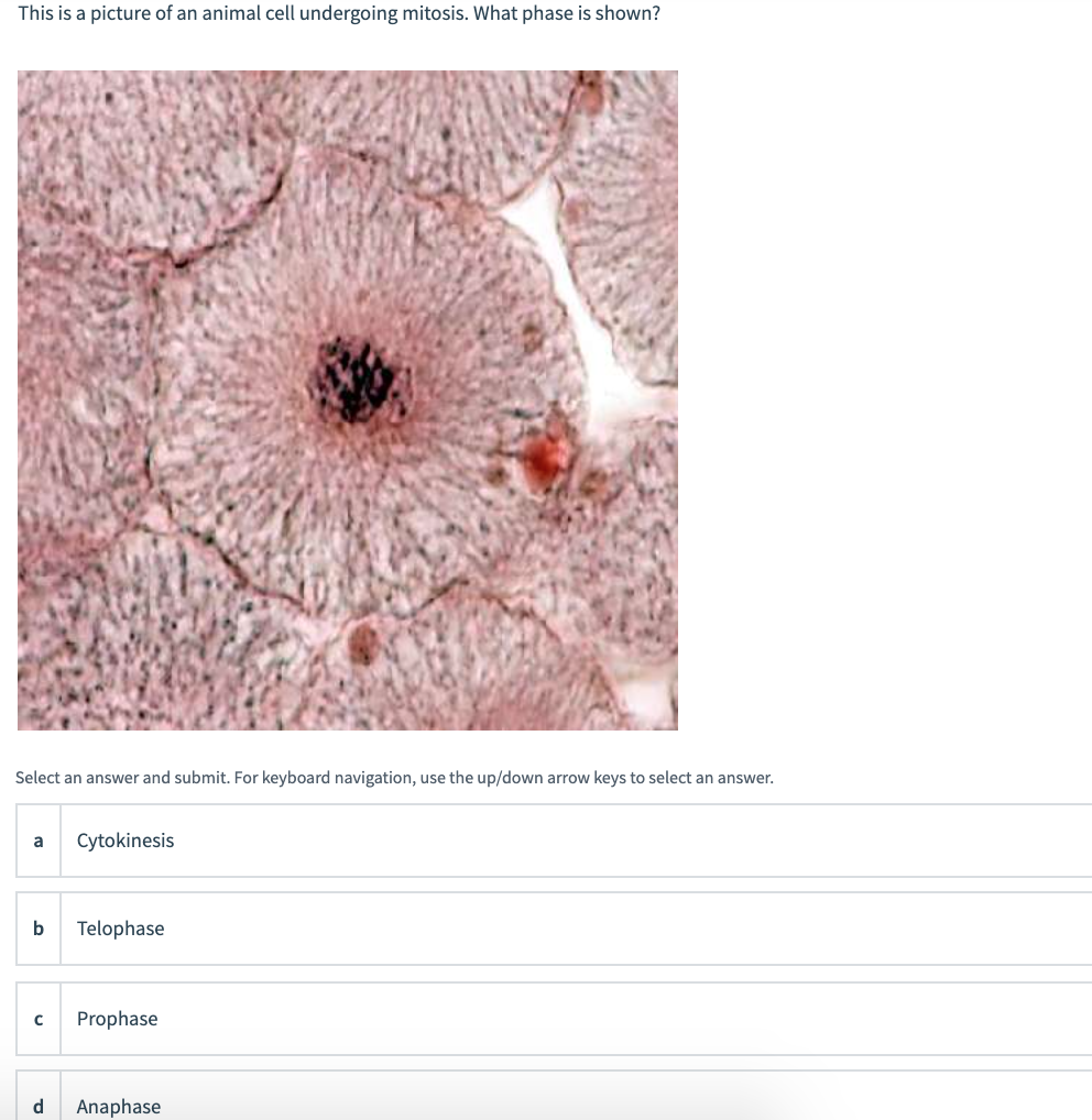 This Is A Picture Of An Animal Cell Undergoing Chegg Com