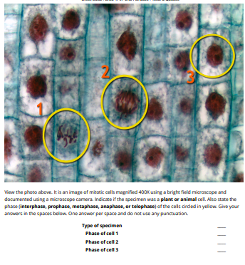 Solved View The Photo Above. It Is An Image Of Mitotic Cells 