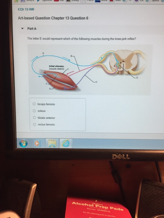 Solved The letter E would represent which of the following | Chegg.com